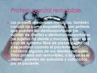  Las prótesis removibles metálicas, también
conocidas como esqueléticas, son prótesis
que pueden ser dentosoportadas (se
sujetan de diente) o dentomucosoportadas
(se sujetan de diente y mucosa, como es el
caso de extremo libre de piezas dentarias)
y se realizan cuando el paciente aún
conserva algunos de sus dientes naturales.
Estas prótesis son removibles, o lo que es lo
mismo, pueden ser extraídas y colocadas
por el paciente.
 