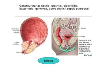    Genotourinaria: cistitis, uretritis, piolenfritis,
    bacteriuria, gonorrea, abort sèptic i sepsis puerperal.




                       cistitis
 