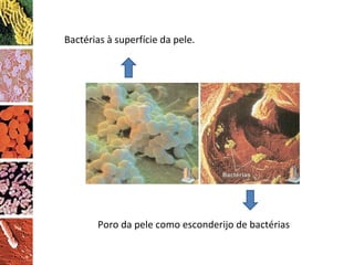 Bactérias à superfície da pele.  Poro da pele como esconderijo de bactérias 