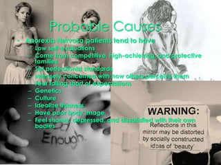 Weight loss achieved by vomiting, laxatives, or diureticsRestrictingWeight loss achieved by restricting caloriesFollowing diets, fasting, and exercising to excess