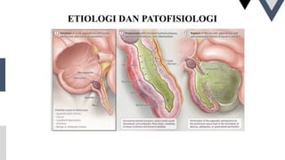 ETIOLOGI DAN PATOFISIOLOGI
 
