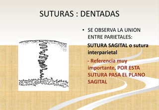 SUTURAS : DENTADAS SE OBSERVA LA UNION ENTRE PARIETALES: SUTURA SAGITAL o sutura interparietal - Referencia muy importante, POR ESTA SUTURA PASA EL PLANO SAGITAL 