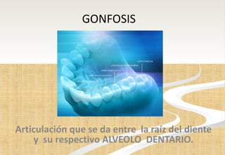 GONFOSIS Articulación que se da entre  la raíz del diente y  su respectivo ALVEOLO  DENTARIO. 
