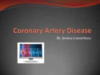 Coronary Artery Disease By: Jessica Canterbury 