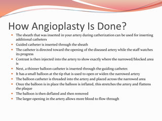Balloon Angioplasty