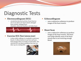 Diagnostic TestsElectrocardiogram (ECG)records the electrical activity of your heart at rest. It can show new heart attack, damaged heart muscle, enlarged heart chambers, abnormal rhythms, and other heart conditionsExercise ECG Test (stress test)is done while walking on a treadmill or stationary bicycle. It allows doctors to see how well your heart pumps when it is made to work harder. The exercise ECG can detect problems that may not show up on a resting ECG.Echocardiogramuses a radioactive substance to produce images of the heart muscle.Heart Scanuses a radioactive substance to produce images of the heart muscle. The heart scan helps identify areas of the heart muscle that is not receiving enough blood.Preparing for the ProcedureNOTHING to eat or drink 6-8 hours before procedureCheck with your doctor several days before because you may be asked to take some medications for a few days beforeBring a list of the names and dosages of ALL the medications you are takingTell the nurse/doctor if you are allergic to any medications, x-ray dye (contrast), iodine/seafood, or if you have a history of bleeding problemsFor you comfort empty your bladder as much as possible before the procedure beginsYou may also be asked to remove any underclothing and jewelry before the procedure