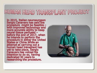 HEAD TRANSPLANT #SciChallenge2017
