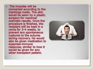 HEAD TRANSPLANT #SciChallenge2017