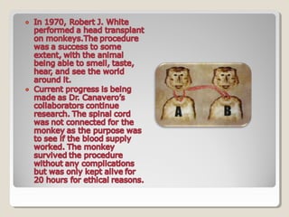 HEAD TRANSPLANT #SciChallenge2017