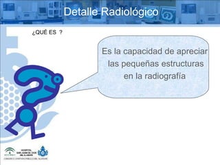 ¿QUÉ ES  ? Detalle Radiológico Es la capacidad de apreciar las pequeñas estructuras  en la radiografía 