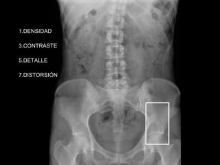 DENSIDAD CONTRASTE DETALLE DISTORSIÓN 