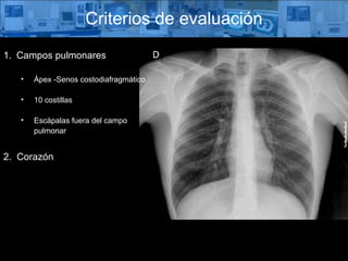 Campos pulmonares Ápex -Senos costodiafragmático 10 costillas Escápalas fuera del campo  pulmonar Criterios de evaluación 2.  Corazón 
