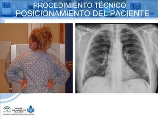 PROCEDIMIENTO TÉCNICO POSICIONAMIENTO DEL PACIENTE 