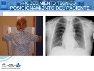 PROCEDIMIENTO TÉCNICO POSICIONAMIENTO DEL PACIENTE 