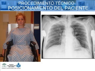 PROCEDIMIENTO TÉCNICO POSICIONAMIENTO DEL PACIENTE 