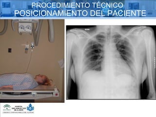 PROCEDIMIENTO TÉCNICO POSICIONAMIENTO DEL PACIENTE 