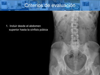 Criterios de evaluación Incluir desde el abdomen superior hasta la sínfisis púbica 