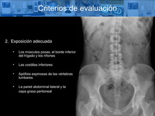 Criterios de evaluación Exposición adecuada Los músculos psoas, el borde inferior del hígado y los riñones Las costillas inferiores Apófisis espinosas de las vértebras lumbares La pared abdominal lateral y la  capa grasa peritoneal 