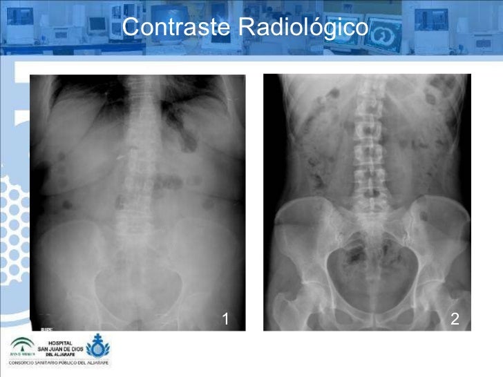 mri con contraste mri con contraste
