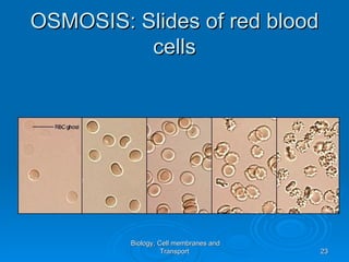 OSMOSIS: Slides of red blood
          cells




         Biology, Cell membranes and
                   Transport           23
 