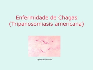 Enfermidade de Chagas
(Tripanosomiasis americana)




         Trypanosoma cruzi
 