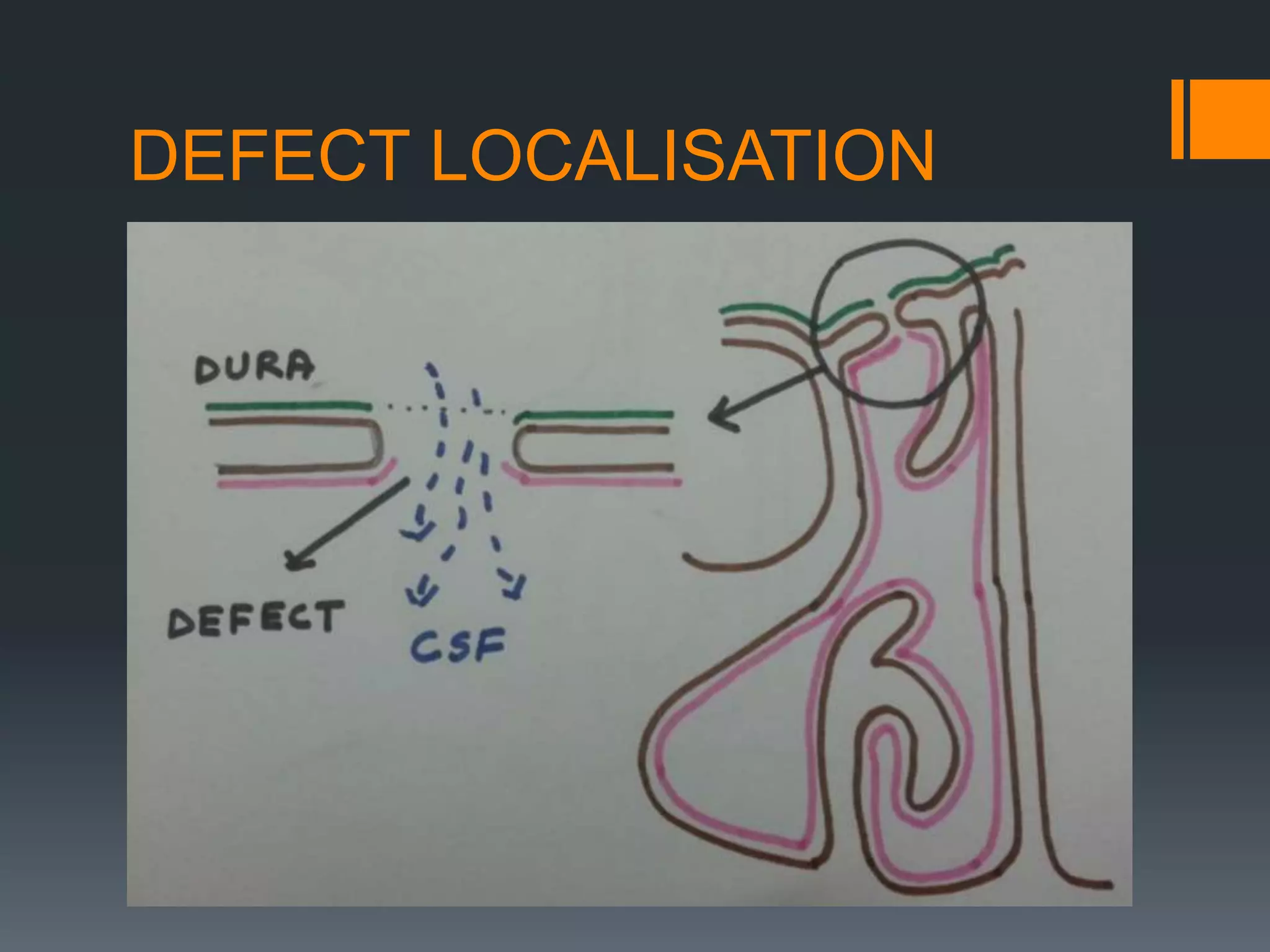 DEFECT LOCALISATION
 