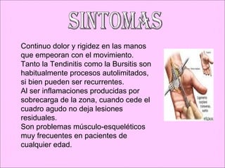 SINTOMAS Continuo dolor y rigidez en las manos que empeoran con el movimiento.  Tanto la Tendinitis como la Bursitis son habitualmente procesos autolimitados, si bien pueden ser recurrentes. Al ser inflamaciones producidas por sobrecarga de la zona, cuando cede el cuadro agudo no deja lesiones residuales. Son problemas músculo-esqueléticos muy frecuentes en pacientes de cualquier edad.  