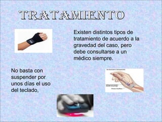 Existen distintos tipos de tratamiento de acuerdo a la gravedad del caso, pero debe consultarse a un médico siempre.   tRATAMIENTO No basta con suspender por unos días el uso del teclado,  