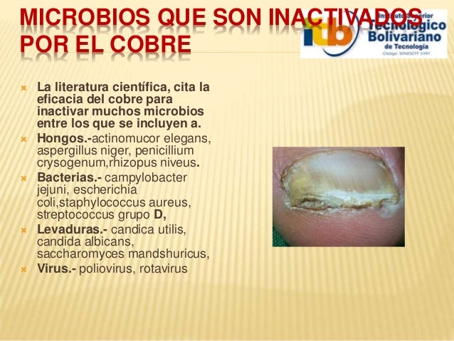 Los indicios y el tratamiento del hongo sobre las uñas