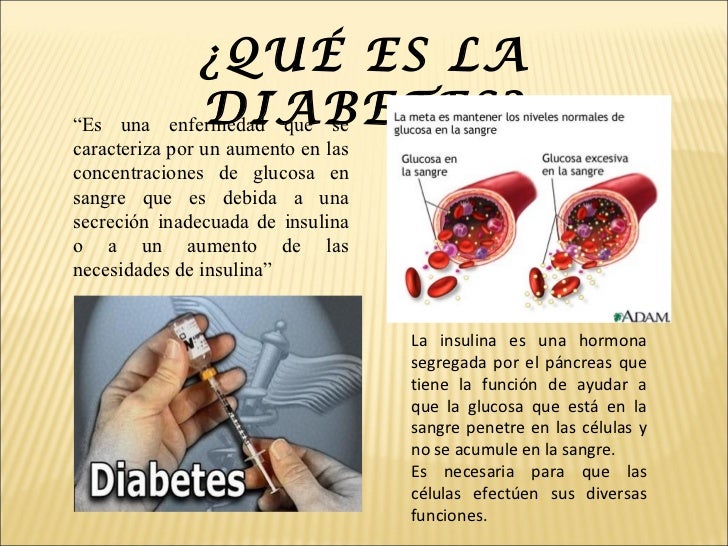 diabetes powerpoint