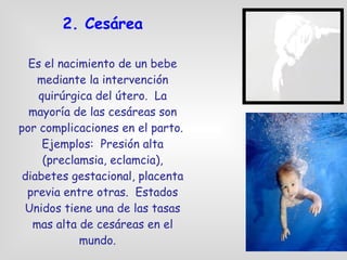 2. Cesárea Es el nacimiento de un bebe mediante la intervención quirúrgica del útero.  La mayoría de las cesáreas son por complicaciones en el parto.  Ejemplos:  Presión alta (preclamsia, eclamcia), diabetes gestacional, placenta previa entre otras.  Estados Unidos tiene una de las tasas mas alta de cesáreas en el mundo.  