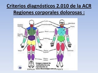 Criterios diagnósticos 2.010 de la ACR
   Regiones corporales dolorosas :
 
