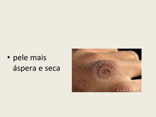 pele mais áspera e seca  