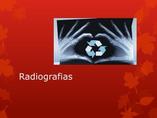 Radiografias

 