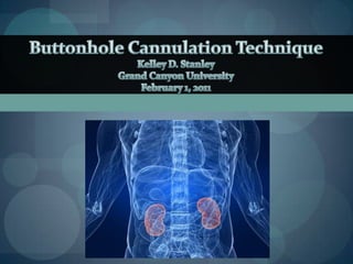 Buttonhole Cannulation Technique Kelley D. Stanley Grand Canyon University February 1, 2011 