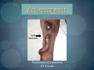 10,000 dialysis patients participated