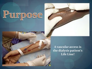   Complications due to problems with vascular access is the number one reason for hospitalization of dialysis patients