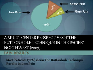 Literature ReviewButtonhole Technique  successfully used in Europe for over 30 yearsinternet search of the literature provided 32 references on the technique; research studies, and journal articles