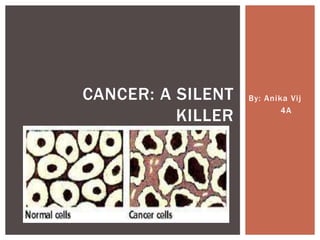 CANCER: A SILENT   By: Anika Vij

          KILLER           4A
 