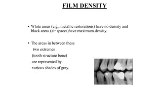 FILM DENSITY
• White areas (e.g., metallic restorations) have no density and
black areas (air spaces)have maximum density.
• The areas in between these
two extremes
(tooth structure bone)
are represented by
various shades of gray.
 
