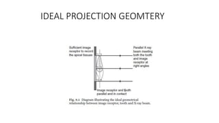 IDEAL PROJECTION GEOMTERY
 