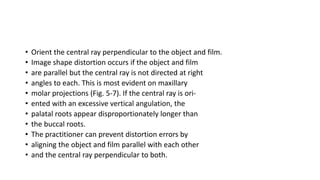 • Orient the central ray perpendicular to the object and film.
• Image shape distortion occurs if the object and film
• are parallel but the central ray is not directed at right
• angles to each. This is most evident on maxillary
• molar projections (Fig. 5-7). If the central ray is ori-
• ented with an excessive vertical angulation, the
• palatal roots appear disproportionately longer than
• the buccal roots.
• The practitioner can prevent distortion errors by
• aligning the object and film parallel with each other
• and the central ray perpendicular to both.
 