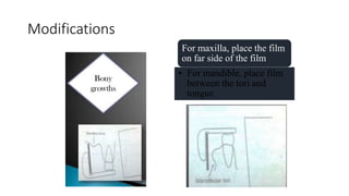 Modifications
For maxilla, place the film
on far side of the film
• For mandible, place film
between the tori and
tongue
 