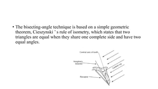 • The bisecting-angle technique is based on a simple geometric
theorem, Cieszynski ’ s rule of isometry, which states that two
triangles are equal when they share one complete side and have two
equal angles.
 