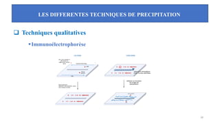 LES DIFFERENTES TECHNIQUES DE PRECIPITATION
28
❑ Techniques qualitatives
▪Immunoélectrophorèse
 