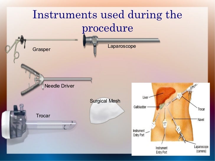 Powerpoint gallbladder