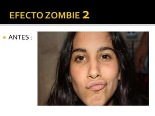 EFECTO ZOMBIE 2ANTES :