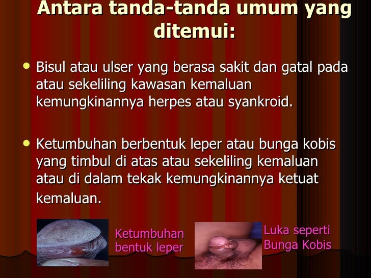 Gatal Di Bahagian Kemaluan Lelaki