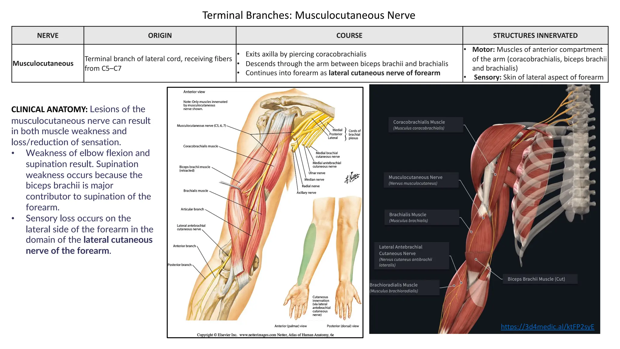NERVE ORIGIN COURSE STRUCTURES INNERVATED
Musculocutaneous
Terminal branch of lateral cord, receiving fibers
from C5–C7
• Exits axilla by piercing coracobrachialis
• Descends through the arm between biceps brachii and brachialis
• Continues into forearm as lateral cutaneous nerve of forearm
• Motor: Muscles of anterior compartment
of the arm (coracobrachialis, biceps brachii
and brachialis)
• Sensory: Skin of lateral aspect of forearm
Terminal Branches: Musculocutaneous Nerve
https://3d4medic.al/ktFP2syE
CLINICAL ANATOMY: Lesions of the
musculocutaneous nerve can result
in both muscle weakness and
loss/reduction of sensation.
• Weakness of elbow flexion and
supination result. Supination
weakness occurs because the
biceps brachii is major
contributor to supination of the
forearm.
• Sensory loss occurs on the
lateral side of the forearm in the
domain of the lateral cutaneous
nerve of the forearm.
 