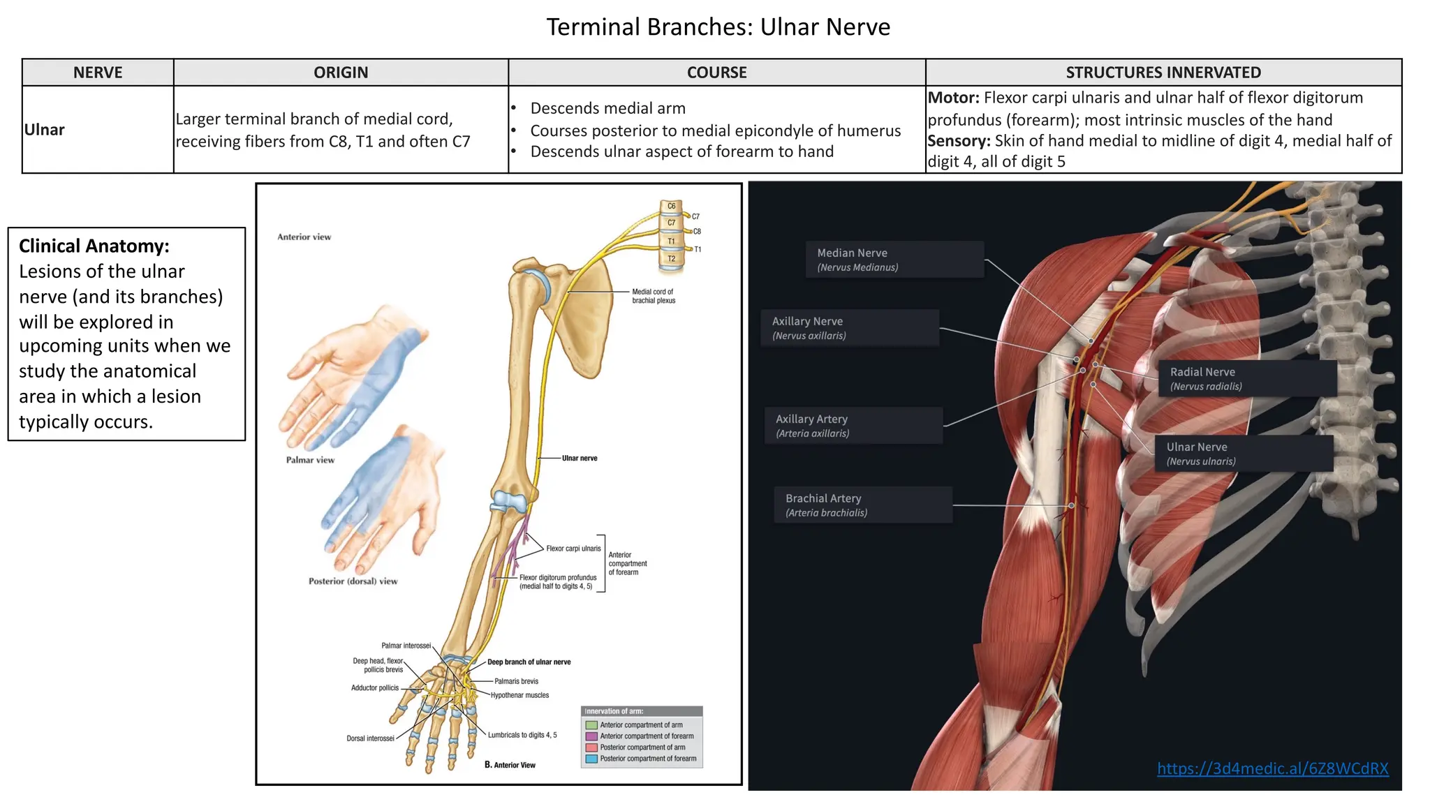 NERVE ORIGIN COURSE STRUCTURES INNERVATED
Ulnar
Larger terminal branch of medial cord,
receiving fibers from C8, T1 and often C7
• Descends medial arm
• Courses posterior to medial epicondyle of humerus
• Descends ulnar aspect of forearm to hand
Motor: Flexor carpi ulnaris and ulnar half of flexor digitorum
profundus (forearm); most intrinsic muscles of the hand
Sensory: Skin of hand medial to midline of digit 4, medial half of
digit 4, all of digit 5
Terminal Branches: Ulnar Nerve
Clinical Anatomy:
Lesions of the ulnar
nerve (and its branches)
will be explored in
upcoming units when we
study the anatomical
area in which a lesion
typically occurs.
https://3d4medic.al/6Z8WCdRX
 